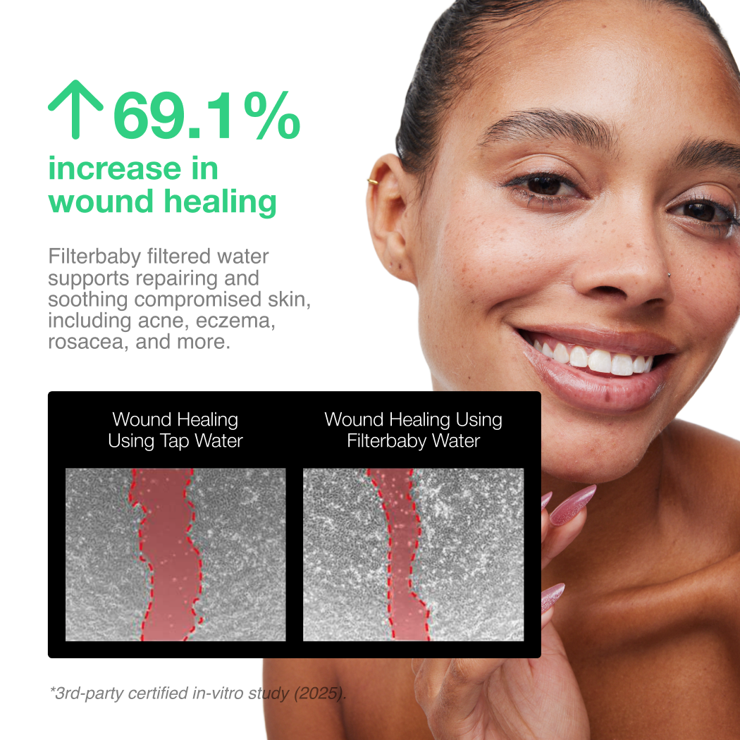 Filterbaby - Filterbaby Skincare Faucet Filter 2.0