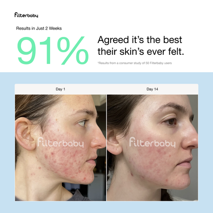 Filterbaby - Filterbaby Skincare Faucet Filter 2.0