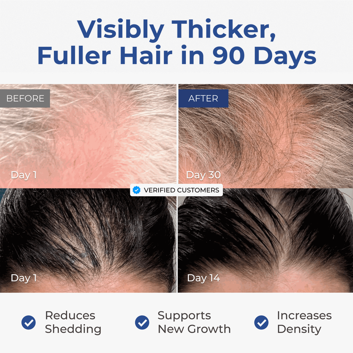 Neurogan Health - Copper Peptide Hair + Scalp Serum | GHK CU Hair Treatment