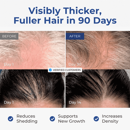 Neurogan Health - Copper Peptide Hair + Scalp Serum | GHK CU Hair Treatment