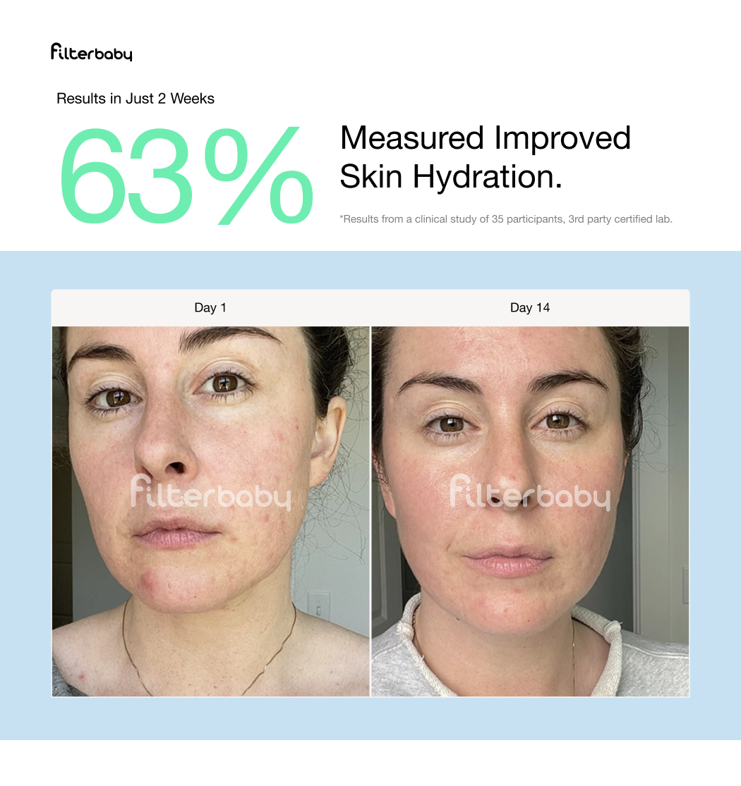 Filterbaby - Filterbaby Skincare Faucet Filter 2.0