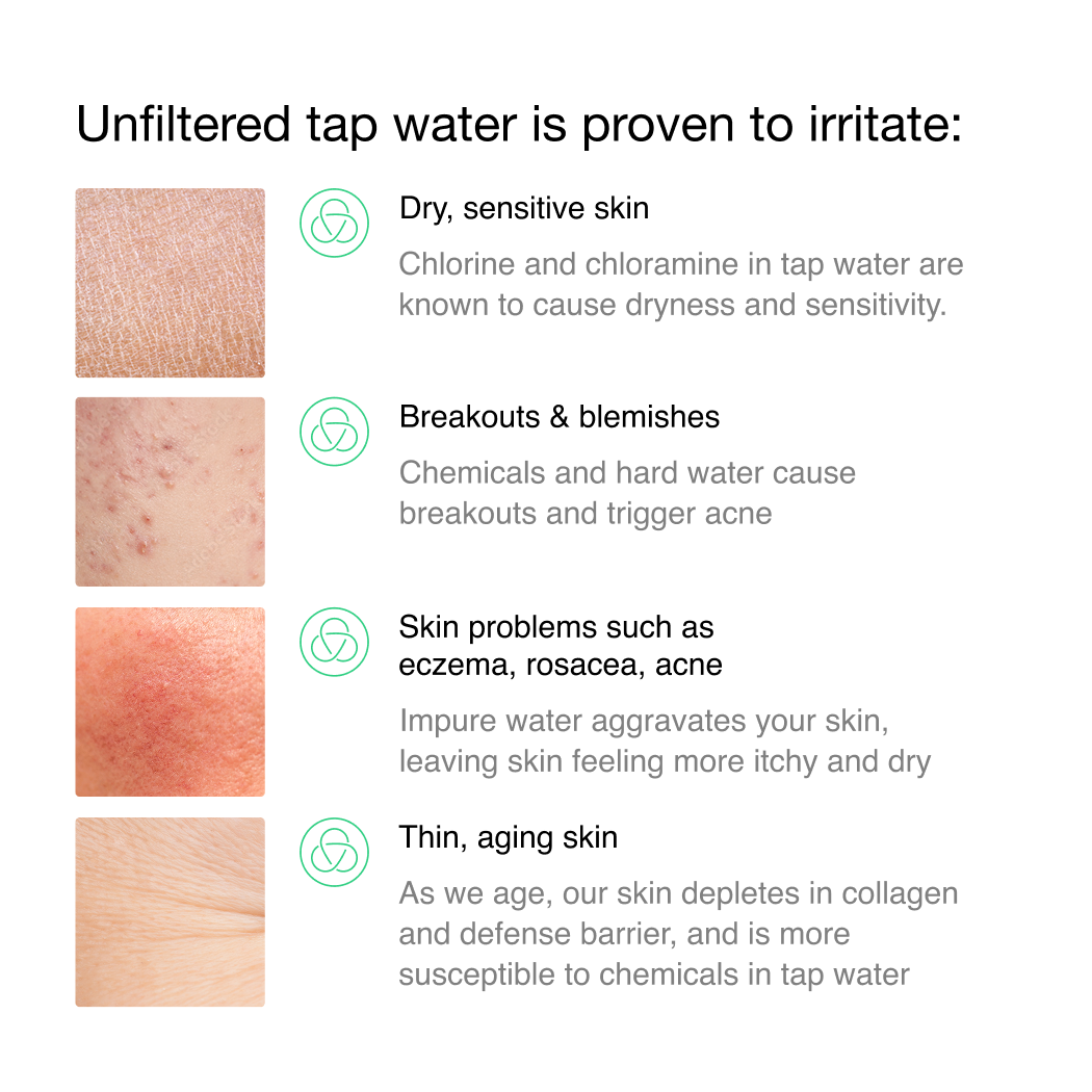 Filterbaby - Filterbaby Skincare Faucet Filter 2.0